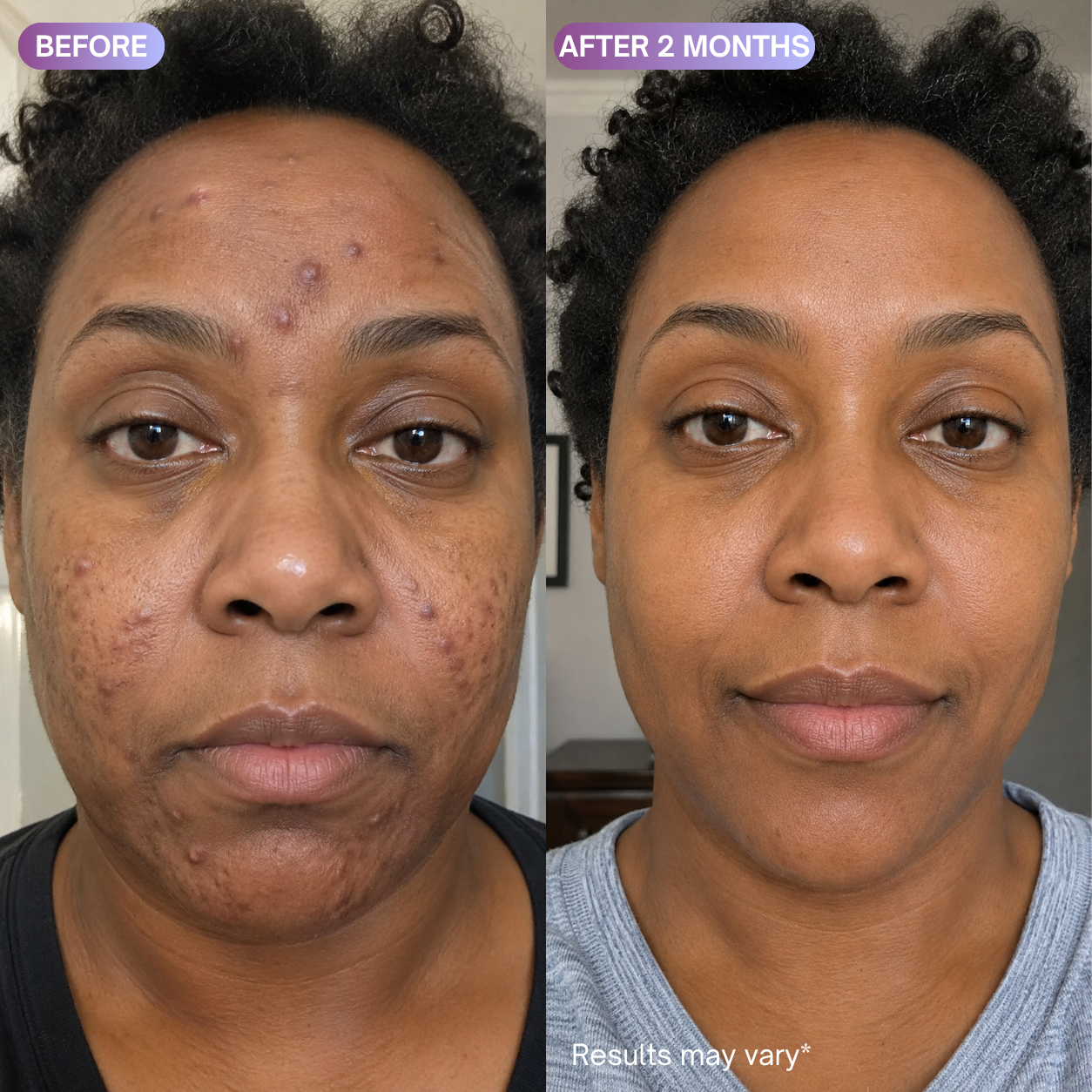 Repair Cream - Copper Peptide