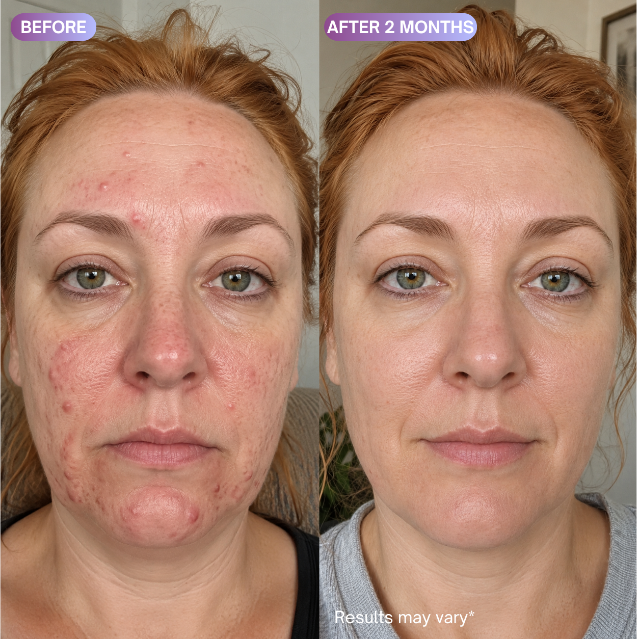 Repair Cream - Copper Peptide