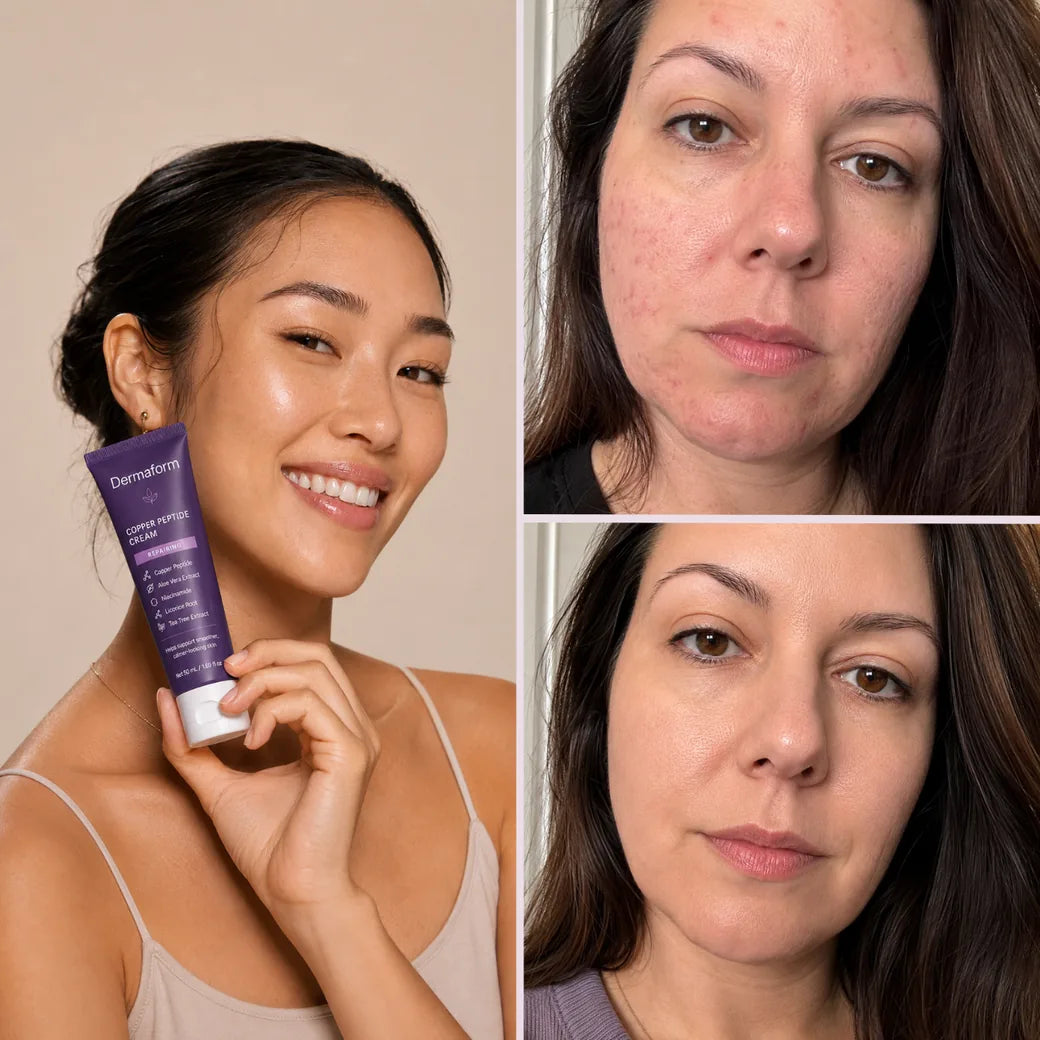 Dermaform skincare result